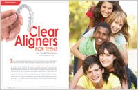 clear aligners for teenagers