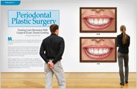 periodontal plastic surgery