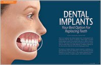 dental implants in elkin nc