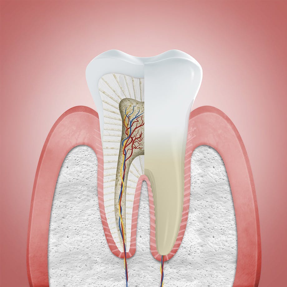 periodontal treatment in elkin, NC