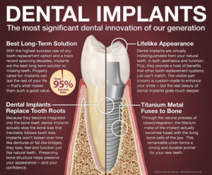 dental implants prevent bone loss