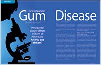 understanding gum disease