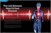 link between heart and gum diseases