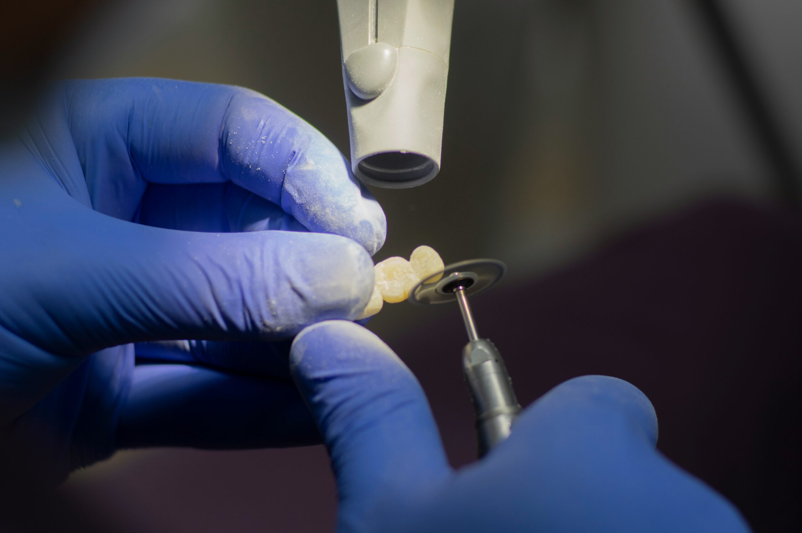 What Are The Advantages and Disadvantages of Dental Crowns?