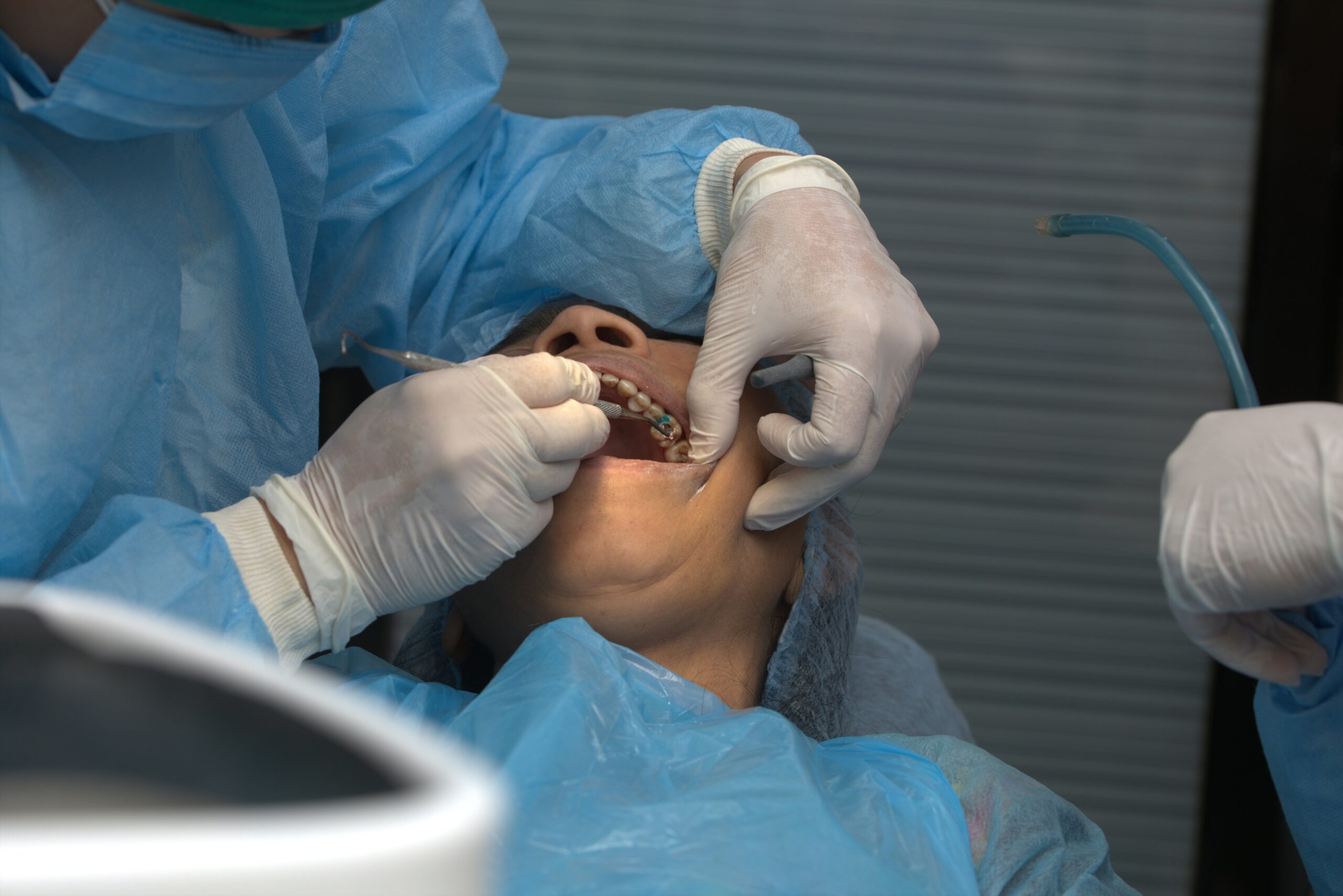 Oral surgery for tooth extraction in Elkin, NC.