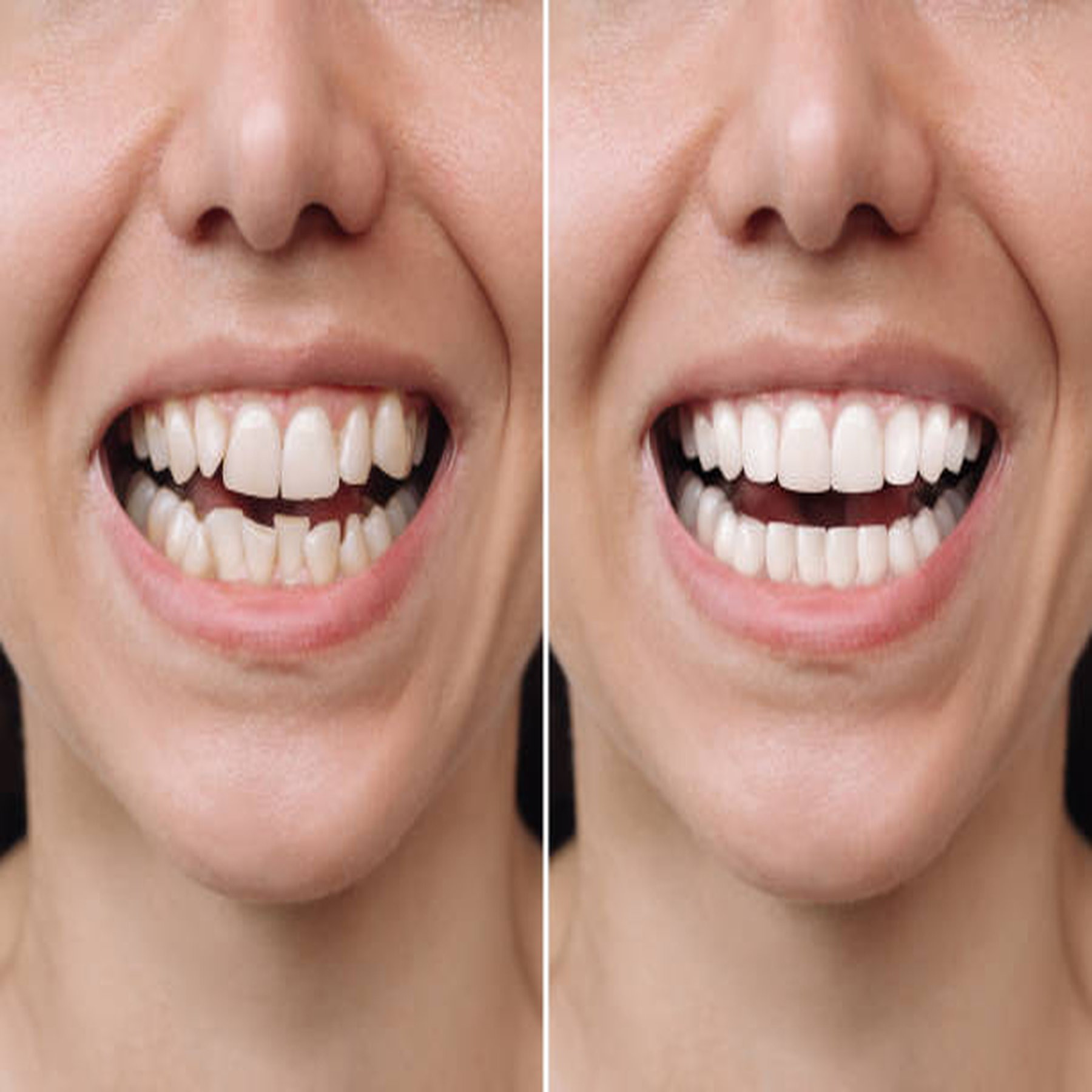 Dental makeover